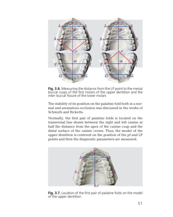 Orthodontics. Modern Methods of Diagnosing Dental Abnormalities, Dentition and Occlusion: tutorial: на англ.яз
