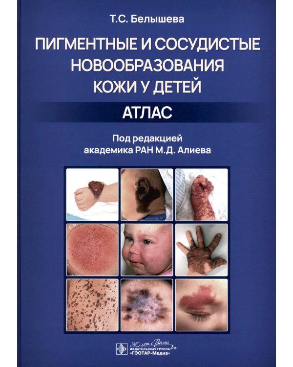 Пигментные и сосудистые новообразования кожи у детей. Атлас