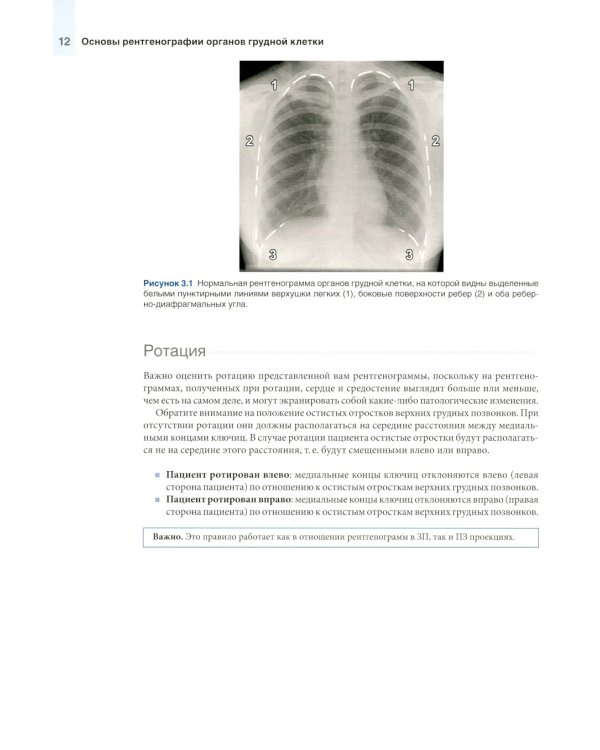 Основы рентгенографии органов грудной клетки
