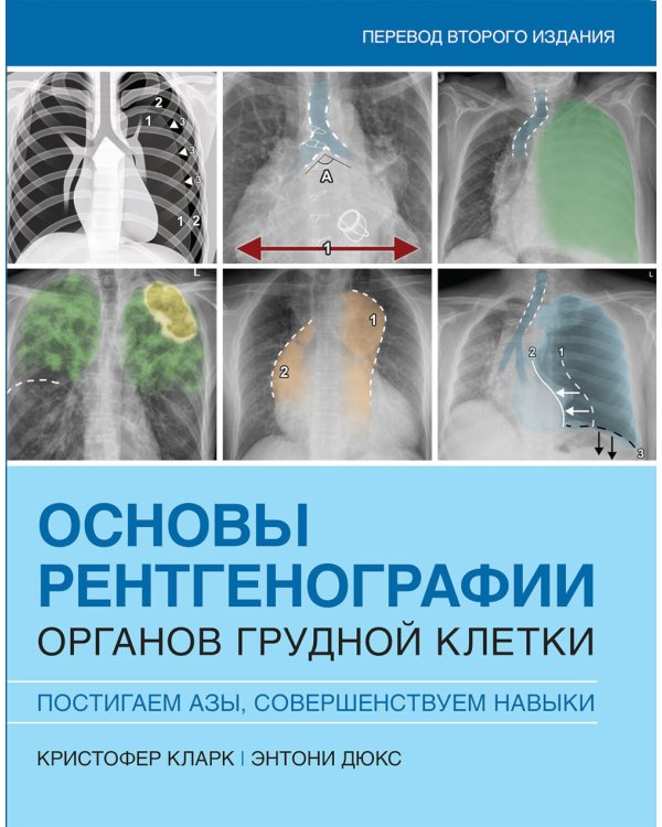 Основы рентгенографии органов грудной клетки