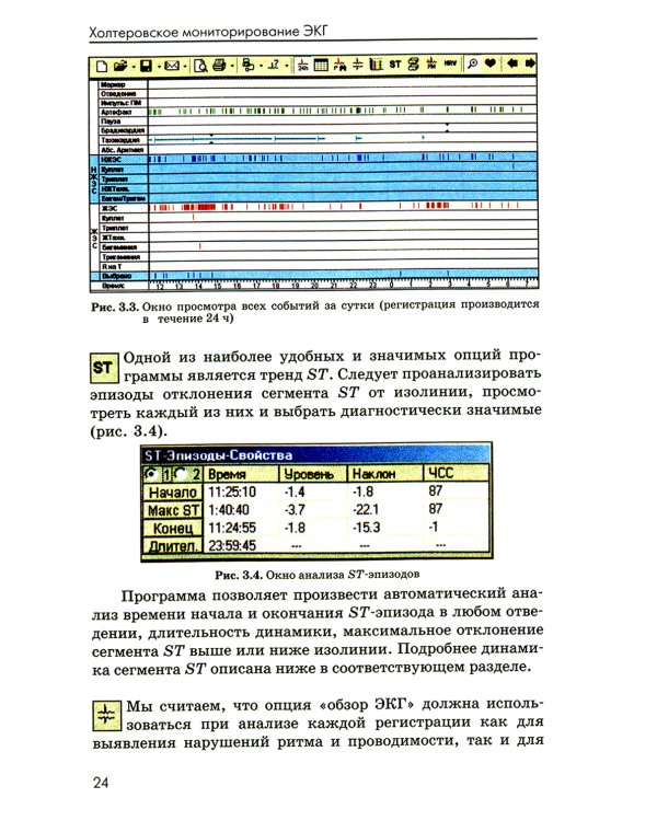 Холтеровское мониторирование ЭКГ: возможности, трудности, ошибки. 4-е изд., испр. и доп