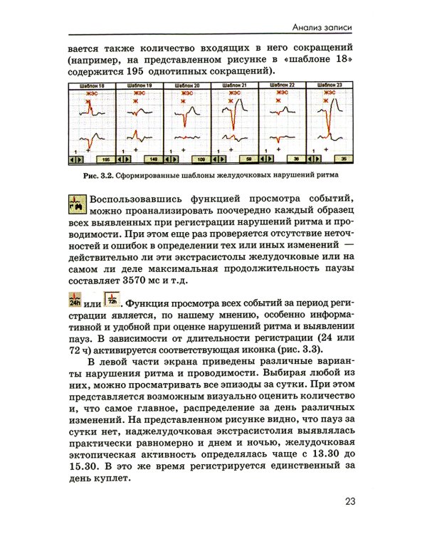 Холтеровское мониторирование ЭКГ: возможности, трудности, ошибки. 4-е изд., испр. и доп