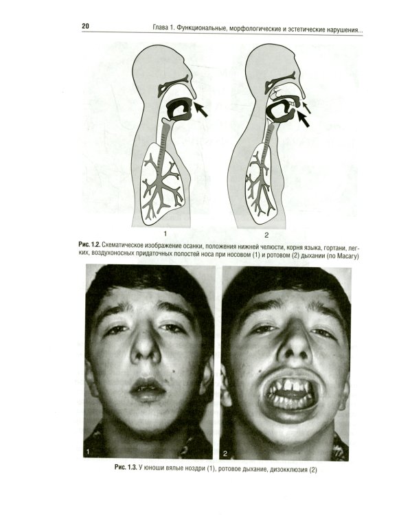 Ортодонтия. Диагностика и функциональные методы профилактики и лечения зубочелюстно-лицевых аномалий: Учебное пособие