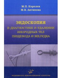 Эндоскопия в диагностике и удалении инородных тел пищевода и желудка