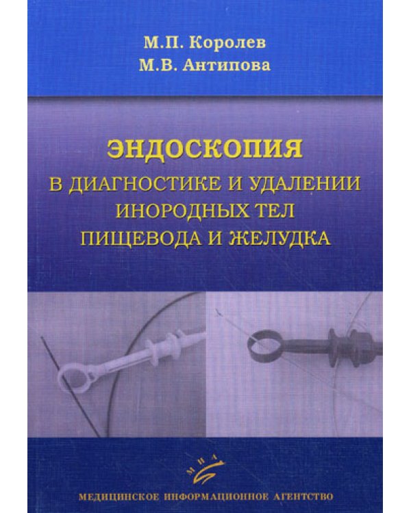 Эндоскопия в диагностике и удалении инородных тел пищевода и желудка