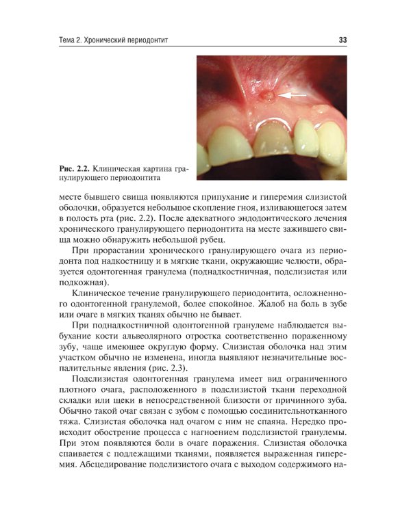 Одонтогенные воспалительные заболевания полости рта. Учебное пособие