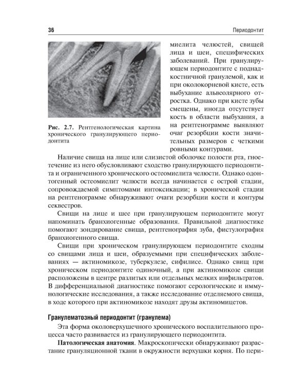 Одонтогенные воспалительные заболевания полости рта. Учебное пособие