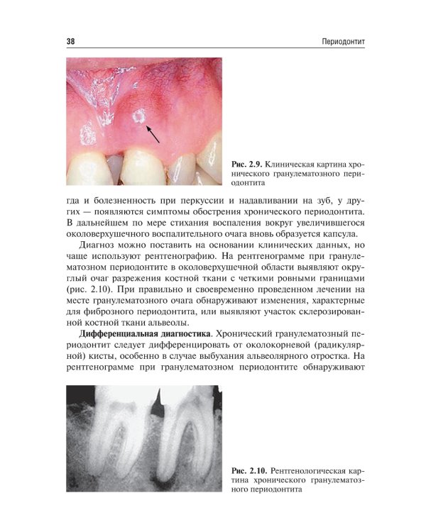 Одонтогенные воспалительные заболевания полости рта. Учебное пособие