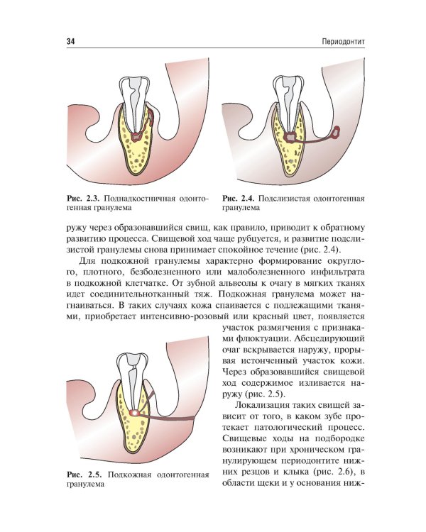 Одонтогенные воспалительные заболевания полости рта. Учебное пособие