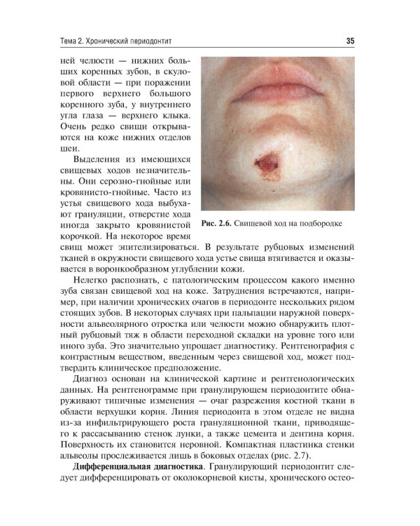 Одонтогенные воспалительные заболевания полости рта. Учебное пособие