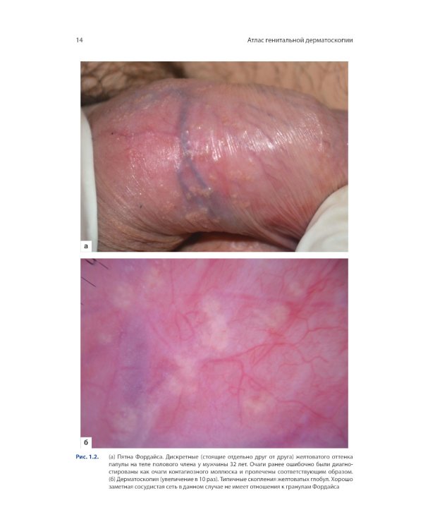 Атлас генитальной дерматоскопии