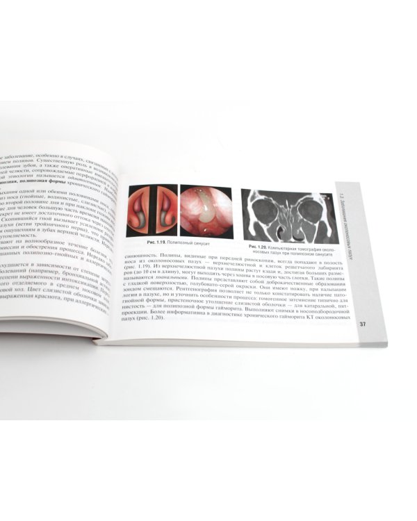 Справочник врача-оториноларинголога