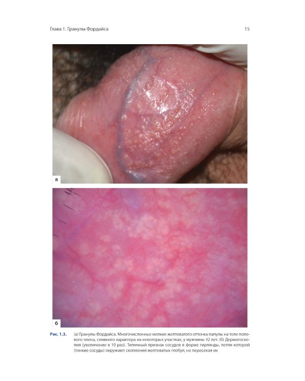 Атлас генитальной дерматоскопии