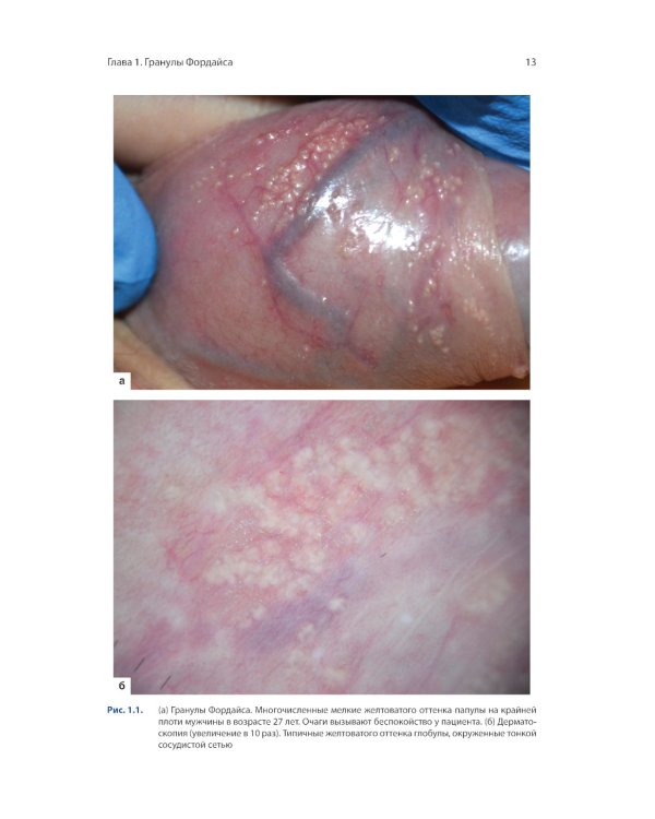 Атлас генитальной дерматоскопии