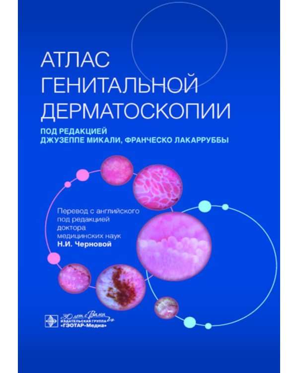 Атлас генитальной дерматоскопии