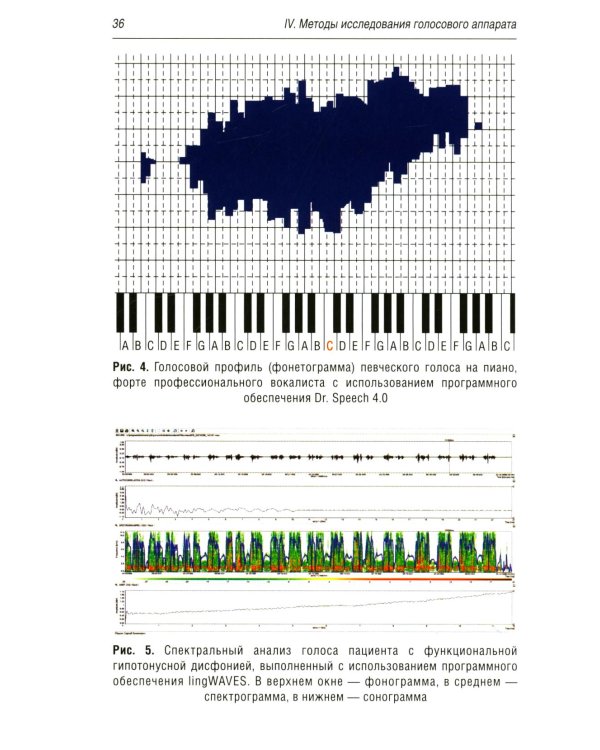 Профессиональные и производственно-зависимые дисфонии: руководство для практикующих врачей