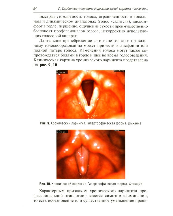 Профессиональные и производственно-зависимые дисфонии: руководство для практикующих врачей