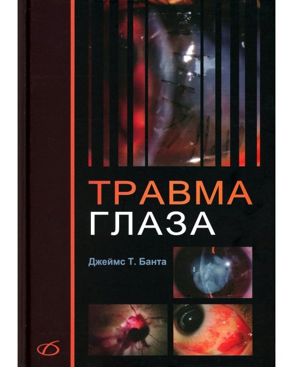 Травма глаза