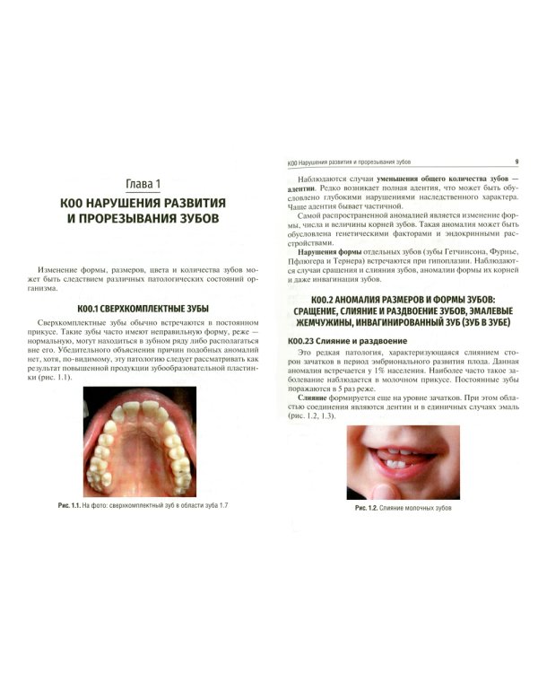 Нарушения развития и формирования зубов: Учебное пособие