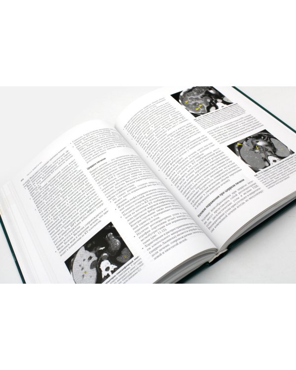 Компьютерная томография: грудь, живот и таз, опорно-двигательный аппарат. 2-е изд (пер.)