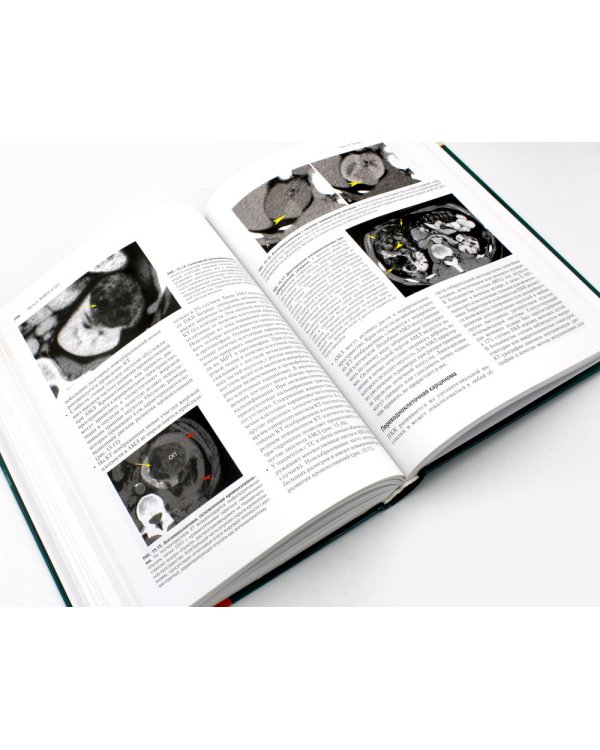 Компьютерная томография: грудь, живот и таз, опорно-двигательный аппарат. 2-е изд (пер.)