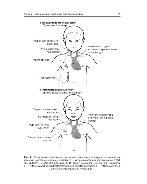 Неотложная помощь пациентам с техническими устройствами в критических состояниях и при обострении хронических заболеваний