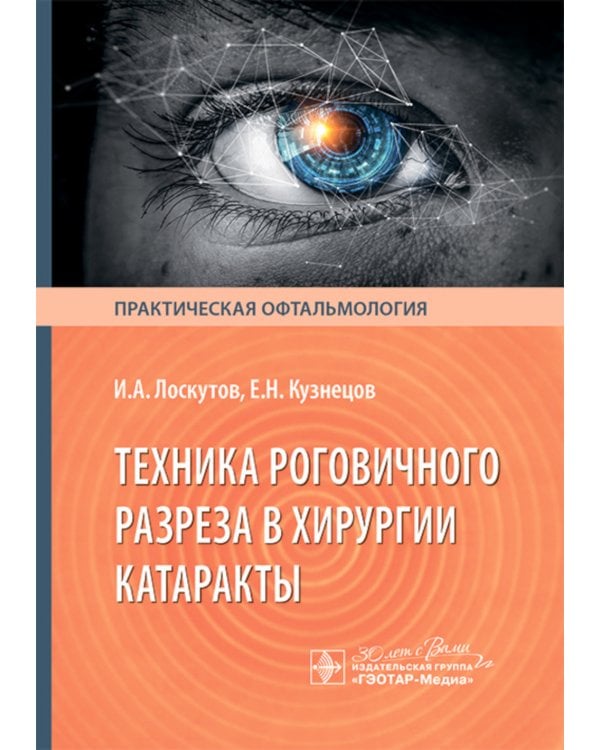 Техника роговичного разреза в хирургии катаракты