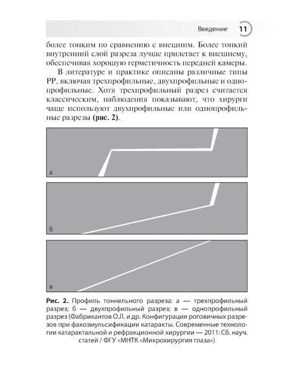 Техника роговичного разреза в хирургии катаракты