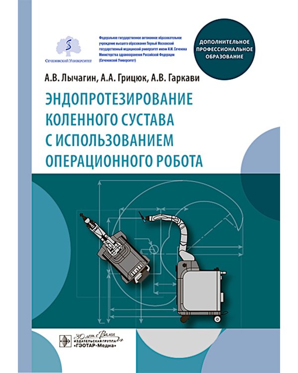 Эндопротезирование коленного сустава с использованием операционного робота: Учебное пособие