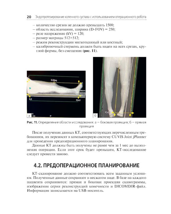 Эндопротезирование коленного сустава с использованием операционного робота: Учебное пособие