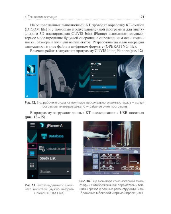 Эндопротезирование коленного сустава с использованием операционного робота: Учебное пособие