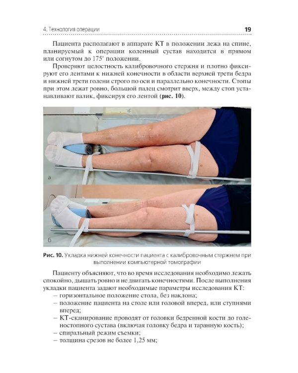 Эндопротезирование коленного сустава с использованием операционного робота: Учебное пособие