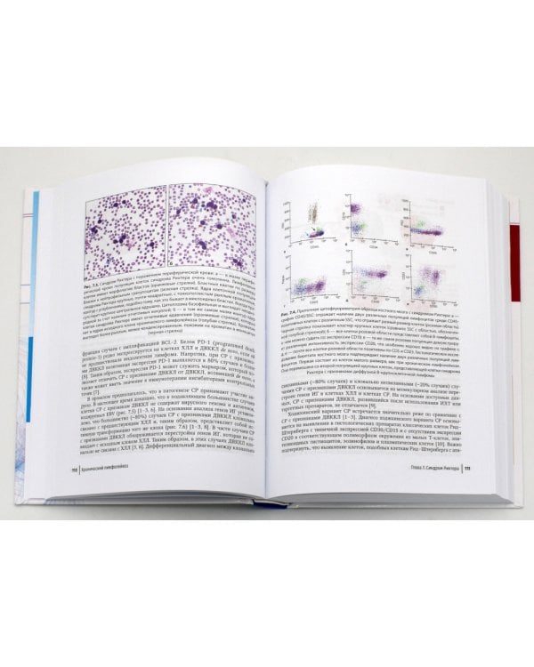 Хронический лимфолейкоз. Современная диагностика и лечение. 2-е изд., перераб. и доп