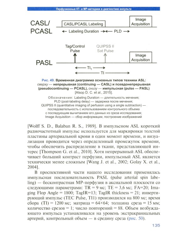 Лучевая диагностика венозного ишемического инсульта