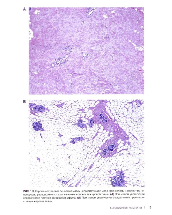 Интерпретация биопсий молочной железы