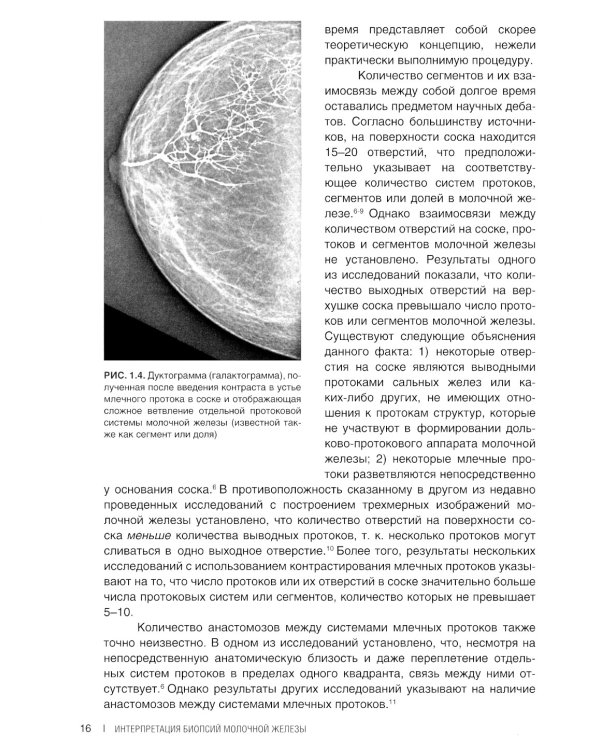 Интерпретация биопсий молочной железы