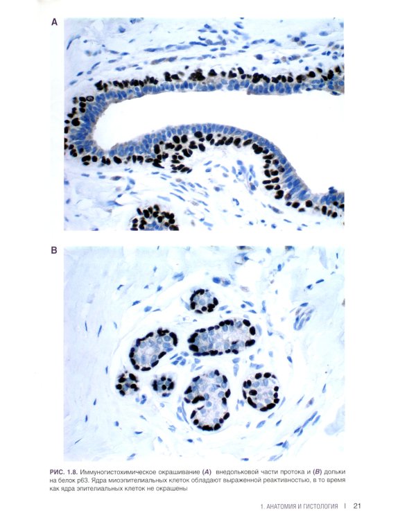 Интерпретация биопсий молочной железы