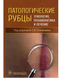 Патологические рубцы. Этиология, профилактика и лечение