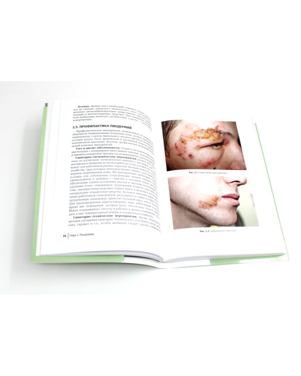 Инфекционные болезни кожи