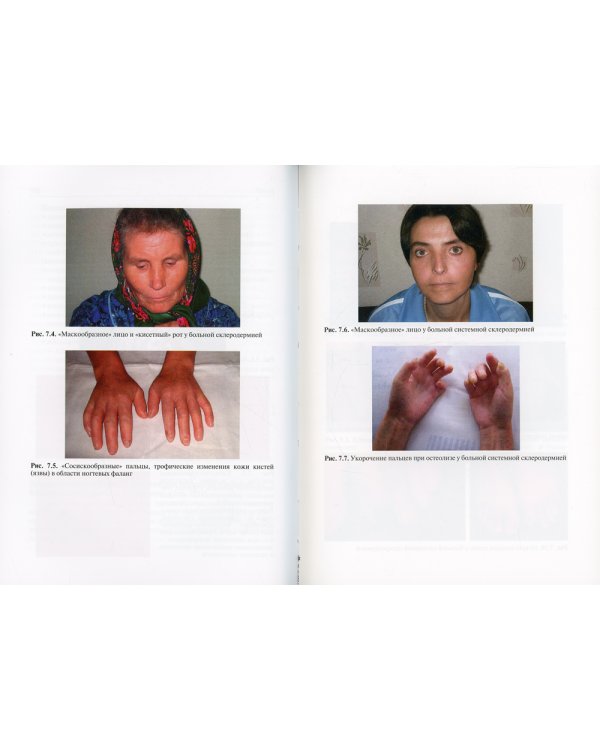 Ревматология: Учебное пособие