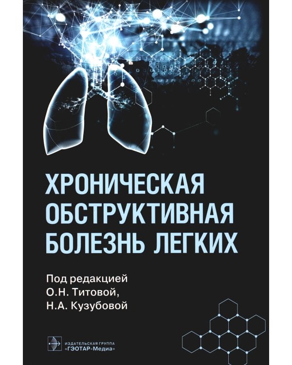 Хроническая обструктивная болезнь легких