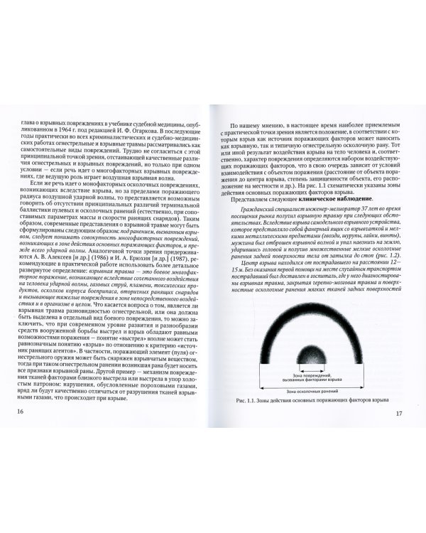 Повреждения живота при взрывах