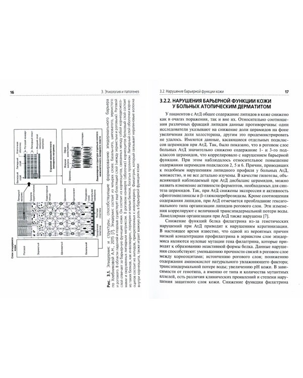 Атопический дерматит: Учебное пособие для врачей