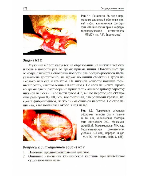 Заболевания слизистой оболочки рта. Геронтостоматология. Тестовые задания, ситуационные задачи: Учебное пособие