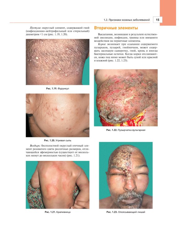 Дерматология в общеврачебной практике. Практическое руководство