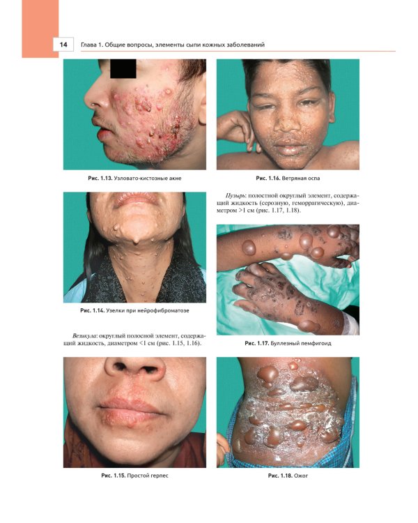 Дерматология в общеврачебной практике. Практическое руководство