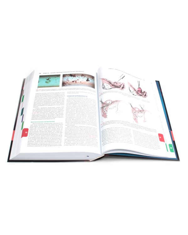 Гинекология по Уильямсу + Оперативная гинекология по Те Линде (комплект из 2-х книг)