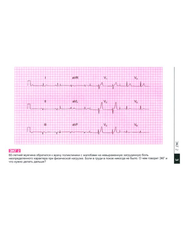 Атлас ЭКГ: 150 клинических ситуаций