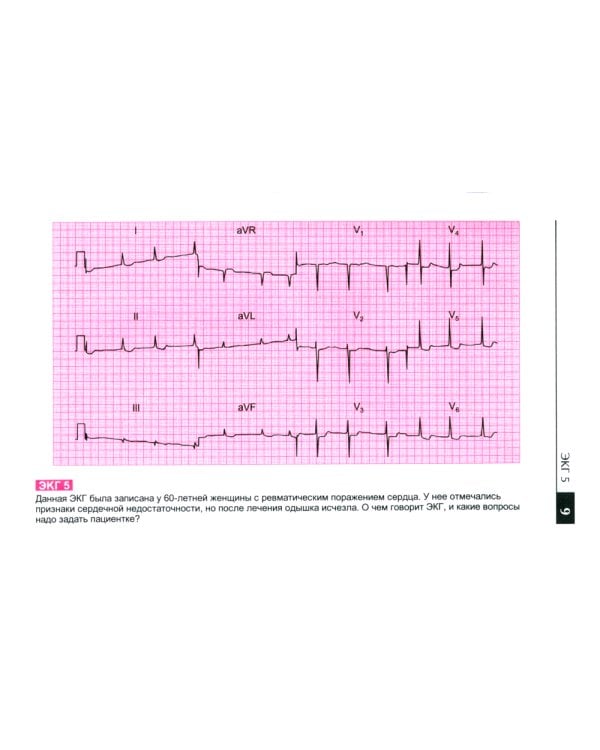 Атлас ЭКГ: 150 клинических ситуаций