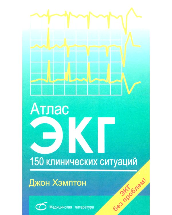 Атлас ЭКГ: 150 клинических ситуаций
